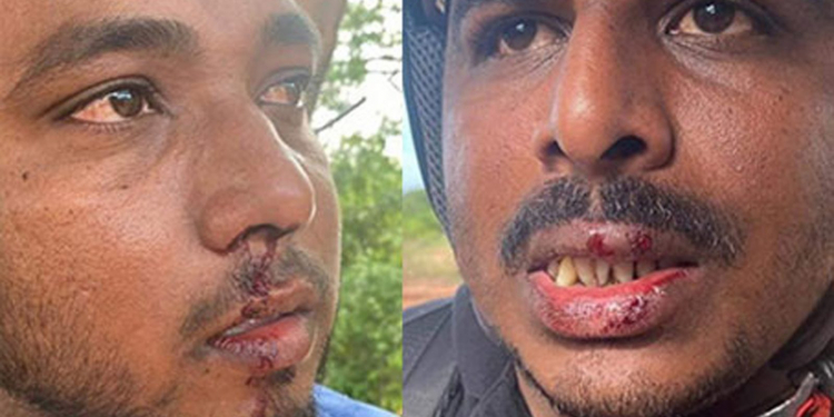 මුලතිව් මාධ්යවේදීන් දෙදෙනෙකුට ප්රහාරයක්