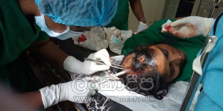 පීසීආර් කරද්දී රිදුණා කියා හිමිනම හෙදියගේ ඔළුව පැලෙන්නම පිඟානකින් ගහලා!