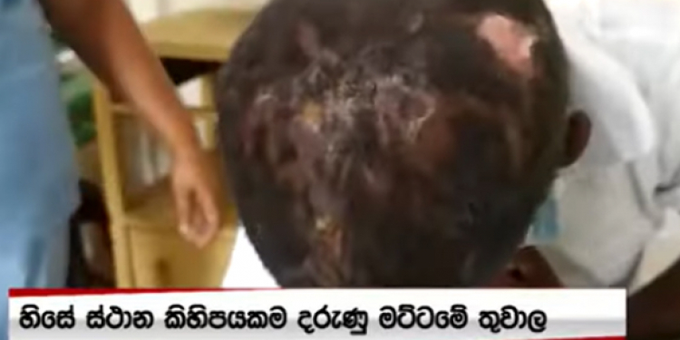 අවුරුදු 14 දැරියට නැන්දා අවුරුදු 2ක් පුරා නොසෑහෙන්න වද දීලා! පුච්චලා! දම්වැලකින් බැඳලා! කුකුල් කූඩුවක දාලා! (VIDEO)