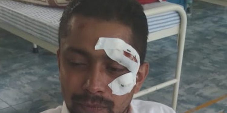 සභාව ඇතුළෙදිම උපසභාපතිවරයාට ආණ්ඩුවේ පැත්තෙන් වීදුරු ප්‍රහාරයක්!