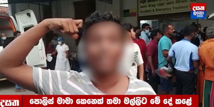 ‘හරේෂ් මල්ලි බහිද්දිම එයාව ඇදලා අරගෙන පිස්ටල් එක තද කළා. එතකොට තමා පිස්ටල් එක පත්තු වුණේ. ඊට පස්සේ හරේෂ් මල්ලි ඇතුළට වැටුණා. මම උස්සලා පොලිස් වීල් එක ඇතුළට දැම්මා..! තිහගොඩ සිසුවාගේ ඔළුවට වෙඩි තැබීමේ සිද්ධියේ ඇසින් දුටු සාක්ෂියක් එළියට එයි! (VIDEO)