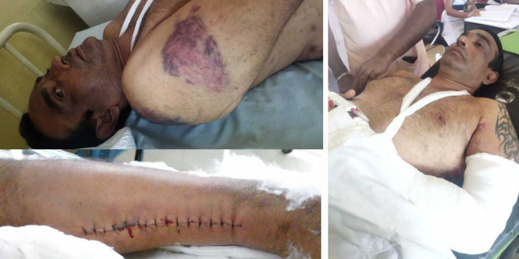 ග්‍රෑන්ඩ්පාස් පොලිසියෙන් පුද්ගලයකුට අමානුෂික පහරදීමක්! ඇඟේ හැමතැනම තැලුම් තුවාල! අතකුත් කඩලා! කකුලේ අඩි දෙකක විතර මැහුමක්! පැමිණිල්ල අස්කරගන්න ලෙසට බලපෑම්! PHOTOS