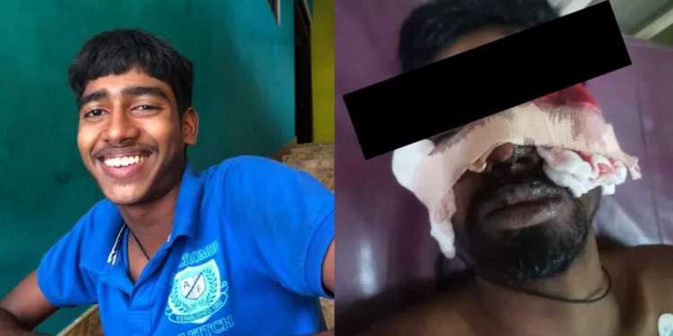 අක්මීමන තරුණයකුගේ මුහුණට පොලිසියෙන් වෙඩි තැබීමේ සිද්ධිය මානව හිමිකම් කොමිසමට යයි! පෞද්ගලික ආරවුලක්! මල්ලි අහිංසකයි! පවුලේ ඥාතීන්ගෙන් පොලිසියට ‌බරපතළ චෝදනාවක්! I Sri Lanka Latest News