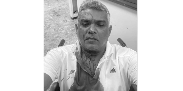 SPC හිටපු සභාපති වෛද්ය සයුරට මැර ප්රහාරයක්! ඇමැතිවරයෙකුගේ නෑදෑකමකුත් ගෑවිලා! Sri Lanka Latest News