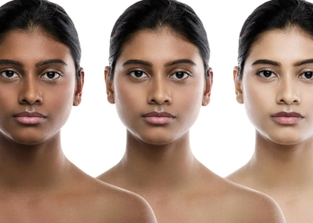 සුදු වෙන්න දඟලන අයගේ ඇස් ඇරෙන කතාවක්!  විශේෂඥ වෛද්‍ය ඉන්දිරා කහවිටගේ මේ කතාව අහල බලන්න I VIDEO I Sri Lanka Latest News