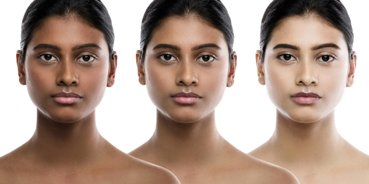 සුදු වෙන්න දඟලන අයගේ ඇස් ඇරෙන කතාවක්!  විශේෂඥ වෛද්‍ය ඉන්දිරා කහවිටගේ මේ කතාව අහල බලන්න I VIDEO I Sri Lanka Latest News