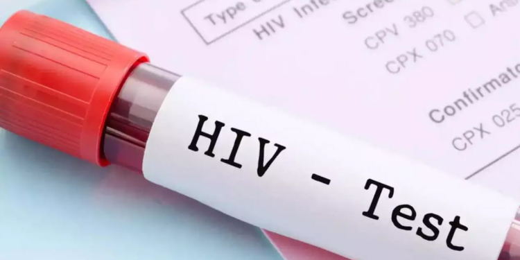 HIV ආසාදිත සංඛ්‍යාව ඉහළට! බාල වයස්කරුවන් රැසකුත් ආසාදිතයන් වෙලා! Sri Lanka Latest News