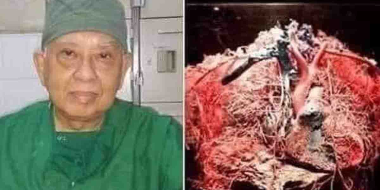 දිනපතා මේ දේවල් කිරීමෙන් පිළිකා හොඳ වෙනවද? ‘දොස්තර ගුප්තා’ කියපු කතාව ඇත්තද? I Sri Lanka Latest News