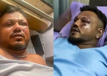 290ක් පිච්චිලා මැරෙද්දී ජීවිතය බේරාගත් සියවසේ මිනිසා පළමුවරට මාධ්යයට කතා කරයි! VIDEO I Sri Lanka Latest News