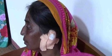 කන කටින් හපලා වෙන්වෙන්නම කඩාගන්නා කාන්තාවක් නුවරඑළියේ! PHOTOS I Sri Lanka Latest News