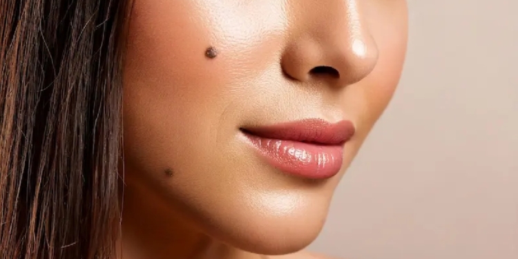 කළු පාටද? රතු පාටද? ඔබේ සිරුරේ සැඟවුණු උපන් ලපේ අද්භූත රහස මෙන්න! Sri Lanka Latest News